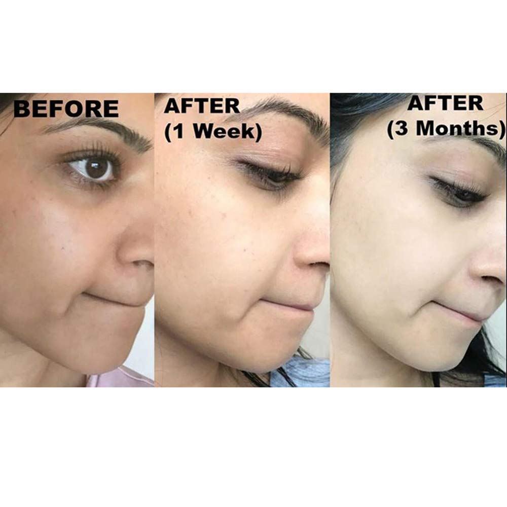 Brighten Your Skin: The Wonders of Kojie San Facial Beauty Soap - Image 6