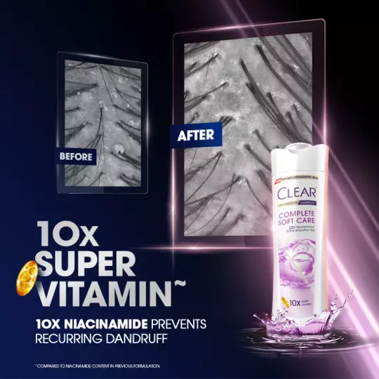 Clear Anti Dandruff Complete Soft Care Shampoo for Healthy Hair 300ml - Image 4