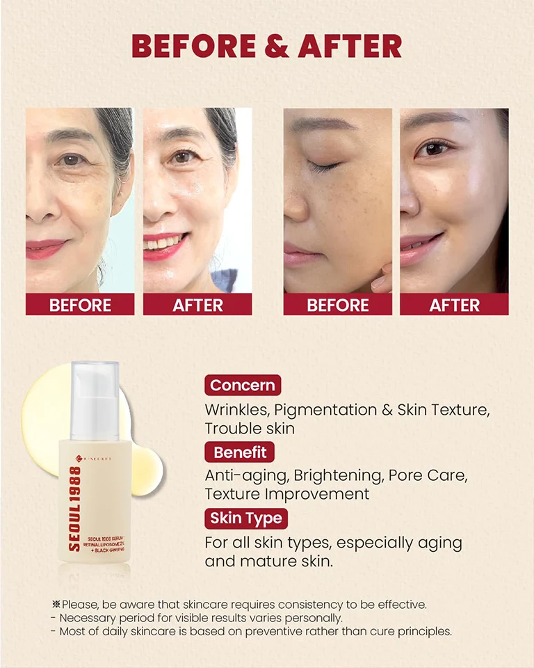 Unlock Radiant Skin with KSecret Seoul 1988 Serum Today 30ml - Image 13